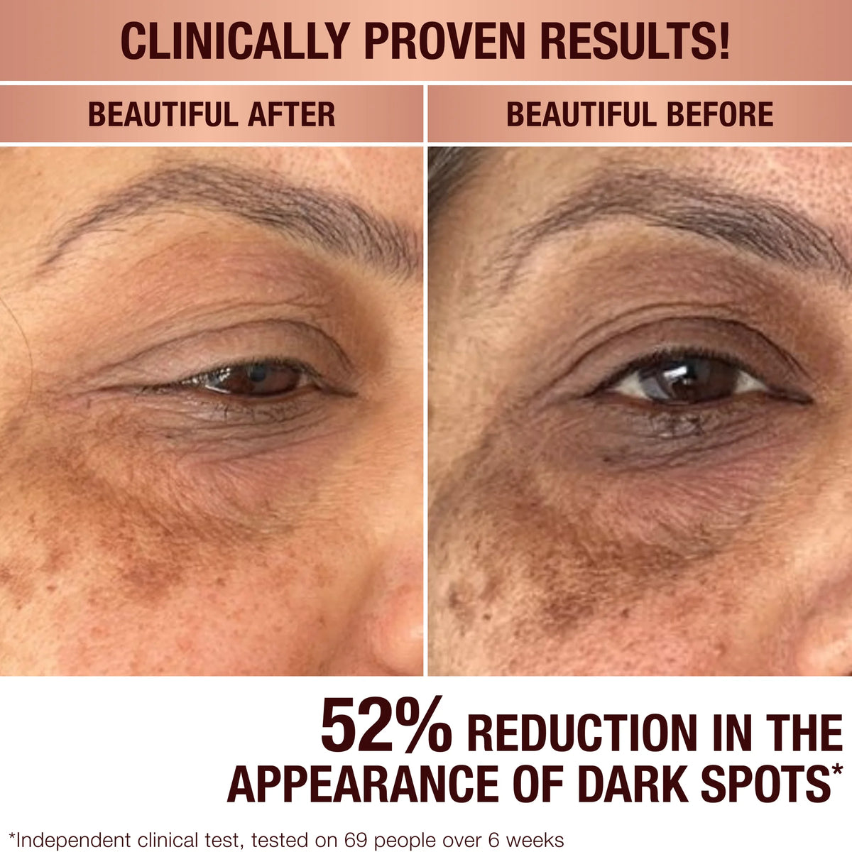 DARK SPOT CORRECTING RADIANCE RECOVERY SERUM 10 ML